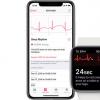 国行Apple Watch如何开通ECG功能 什么是ECG功能