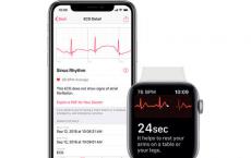 国行Apple Watch如何开通ECG功能 什么是ECG功能